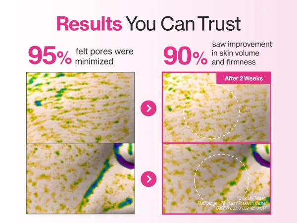 Numbuzin No.2 Rose PDRN Overnight Collagen Mask - 37gr - Image 4